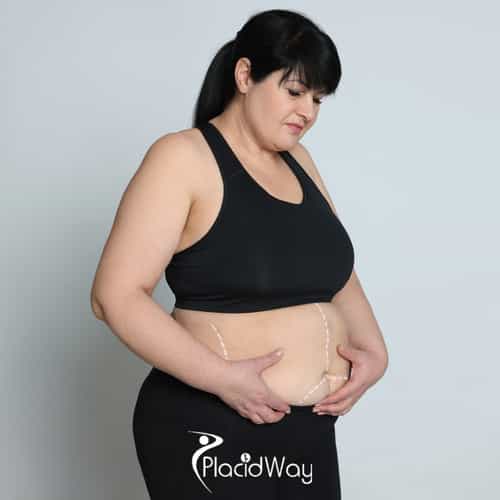 Gastric Sleeve in Turkey vs Spain - Comparing €4,000 All-Inclusive Packages for Irish Seekers, Brands, and Quality Standards Compared